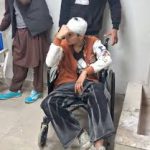 18-Year-Old Kashmiri Shawl Seller Assaulted in Uttarakhand’s Vikas Nagar, Suffers Fractures and Head Injuries 18-Year-Old Kashmiri Shawl Seller Assaulted in Uttarakhand’s Vikas Nagar, Suffers Fractures and Head Injuries
