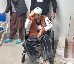 images (69) 18-Year-Old Kashmiri Shawl Seller Assaulted in Uttarakhand’s Vikas Nagar, Suffers Fractures and Head Injuries