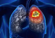 32,425 Cancer Cases Reported in J&K in Three Years: J&K Health Ministry 32425 Cancer Cases Reported in J&K in Three Years: J&K Health Ministry